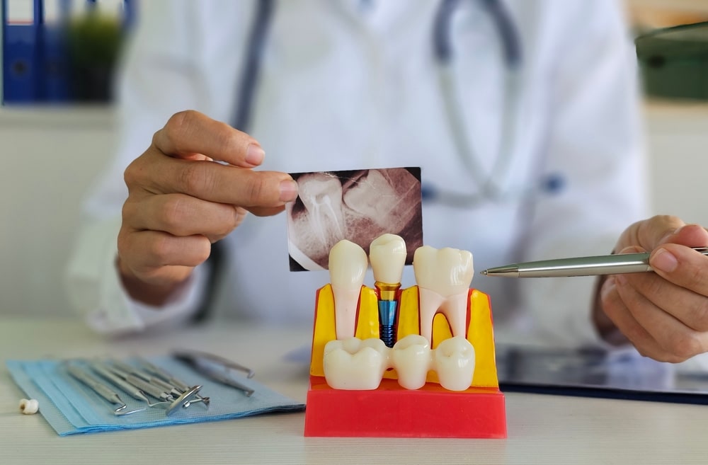 tooth replacement options